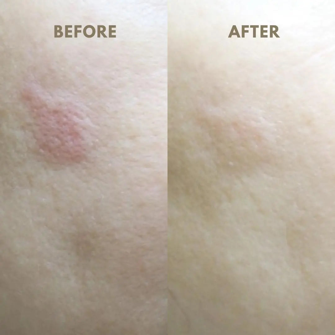 Facial Mask – Revitalizing Sheet Mask